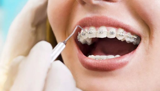 Why More Dentists Are Enrolling In Orthodontic Courses