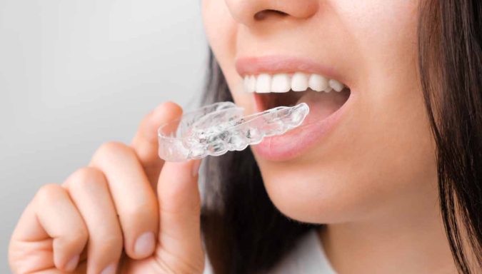 Can Modern Orthodontics Help Prevent Future Dental Problems?