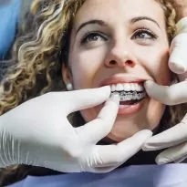 Doctor putting a clear dental aligner to the patient woman
